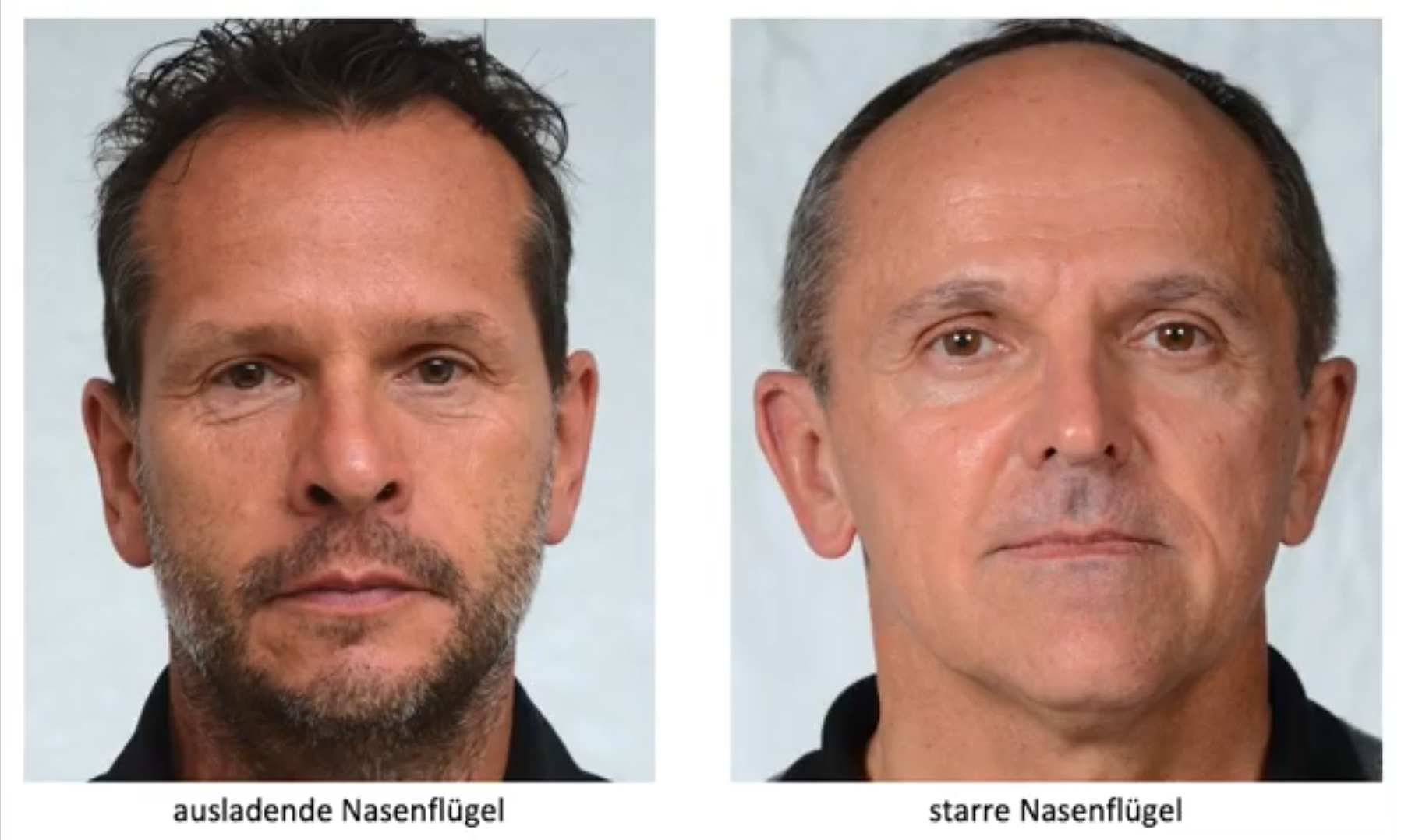 Die Nasenfluegel im Face Reading